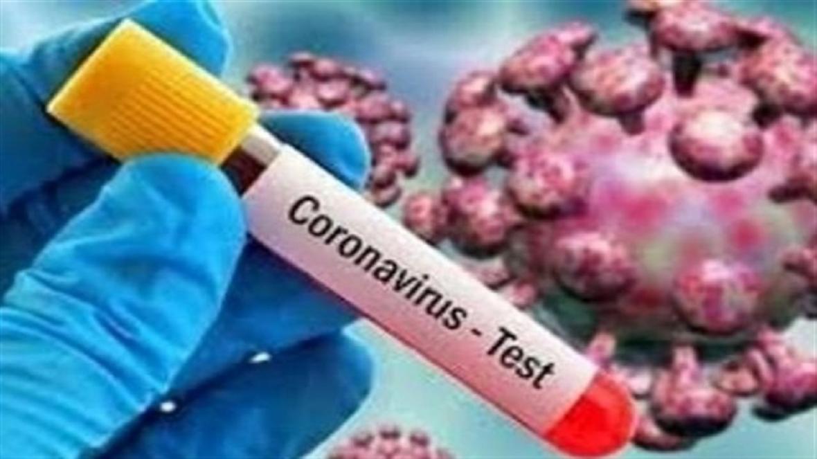 افزایش بیماری کرونا در مناطق تحت پوشش دانشگاه علوم پزشکی افزایش بیماری کرونا در مناطق تحت پوشش دانشگاه علوم پزشکی مشهد، مردم نکات بهداشتی را رعایت کنند